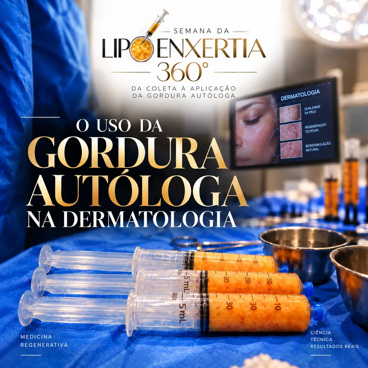 Arte: o uso da gordura autóloga na especialidade DERMATOLOGIA